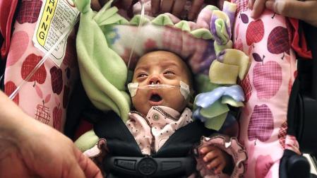 Una bebé hispana que nació 16 semanas antes de lo previsto, considerada una de las bebés más pequeñas del mundo en sobrevivir, fue dada de alta hoy de un hospital de Los Ángeles. Melinda Star Guido nació el 30 de agosto pasado, a las 24 semanas de gestación, pesando sólo 9,5 onzas (269 gramos) (menos que una lata de bebida gaseosa), y hoy al ser dada de alta del Centro Médico LAC+USC pesó 4,5 libras (454 gramos). EFE (EE.UU)