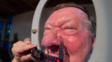 Un holandés, campeón mundial de narigones