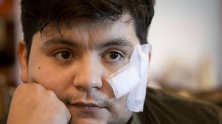 “Me gustaría que el que me cortó sepa que me ha paralizado la cara”