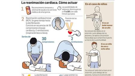 Procedimiento gráfico de actuación con el desfibrilador