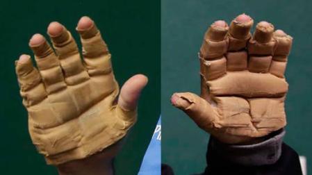 Las manos de Urrutikoetxea (izda.) y Bengoetxea (dcha.)