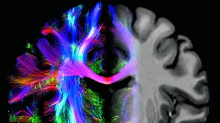 El cerebro mide 150.000 kilómetros
