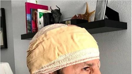 Padilla se prepara para San Fermín tras la aparatosa cogida del 7 de julio