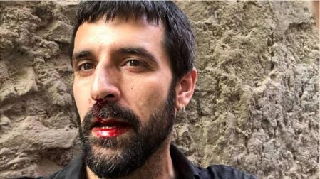 La Policía expedienta a un agente denunciado por agredir a un fotoperiodista