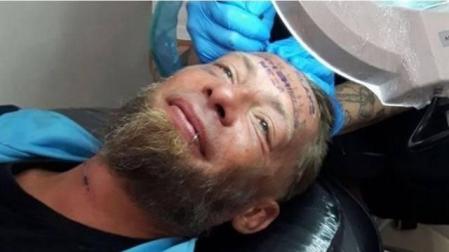 Investigan en Benidorm si un grupo de británicos pagó a un indigente por tatuarse la frente