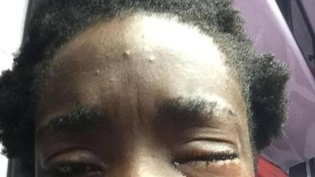 Las agresiones a extranjeros disparan "la alarma racismo" en Italia