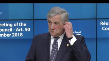 El presidente de la Eurocámara se pinta un ojo contra la violencia machista