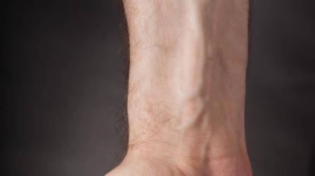 La mortalidad por cáncer de pulmón se iguala en hombres y mujeres menores de 45