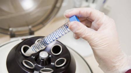 30 mujeres congelan sus óvulos cada año porque han sido diagnosticadas de cáncer