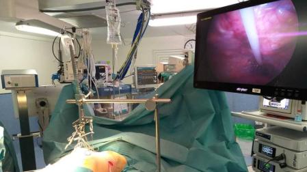 Una intervención de “pectus excavatum” o “pecho hundido”.