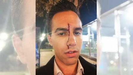 Un periodista y su novio denuncian una agresión homófoba en Barcelona