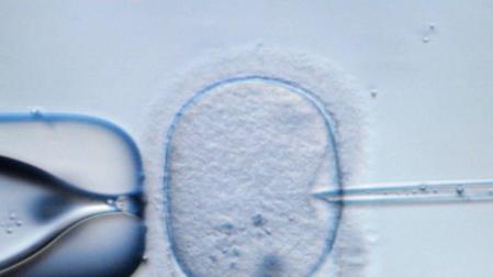 30 años de la primera fecundación in vitro de la Sanidad Pública