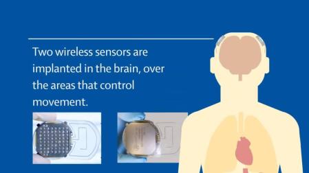 El exoesqueleto para tetrapléjicos controlado por el cerebro, cerca de ser realidad
