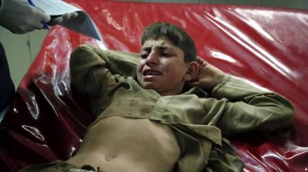 Un niño herido en el atentado contra una mezquita en Afganistán, es atendido tras el ataque.