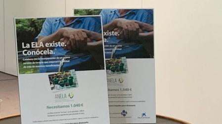 Nuevo servicio de terapia ocupacional para enfermos de ELA