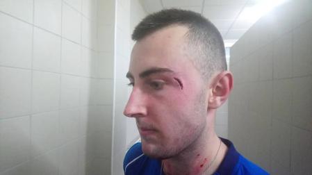 Susto y costurón para Bakaikoa en el telonero