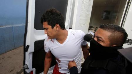 Uno de los presos heridos llega al hospital.