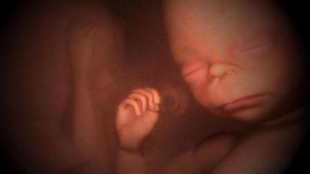 Expertos no logran frenar los casos de gemelos por fecundaci&oacute;n in vitro