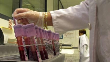 Un análisis de sangre para predecir enfermedades crónicas