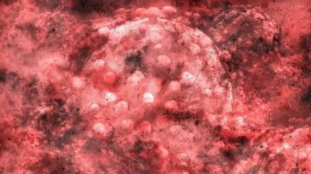 ¿Nuevas terapias para COVID-19? Sus factores de riesgo dan pistas