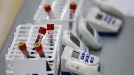 Sanidad registra otras nueve muertes y 99 contagios de covid en 24 horas