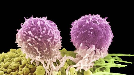 La primera inmunoterapia  española contra el cáncer  pasa por Navarra
