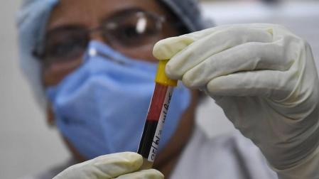 El plasma hiperinmune podría reducir los ingresos en UCI o fallecimientos por covid
