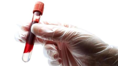 La biopsia líquida, la "revolución" que cambiará la forma de tratar el cáncer