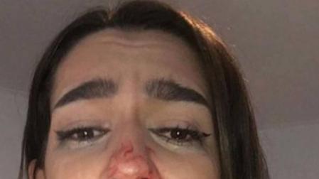 Una joven pamplonesa denuncia una agresión tránsfoba en Barcelona