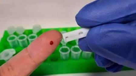 El CSIC diseña un test de anticuerpos para covid-19 más sensible y fiable al 99%
