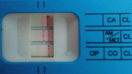 Test de drogas positivo.