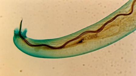 Angiostrongylus cantonensis, gusano pulmonar de las ratas.