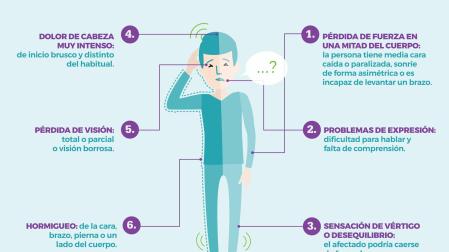 Seis señales de alarma para detectar un ictus