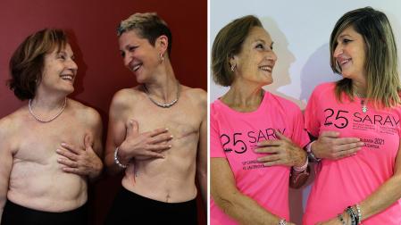 MAYO DE 2017 María Cemboráin e Izaskun Echechipia, mostrando hace cuatro años las cicatrices de sus mastectomías y OCTUBRE DE 2021 María Cemboráin e Izaskun Echechipia, esta semana con las camisetas conmemorativas del 25 aniversario de la asociación Saray