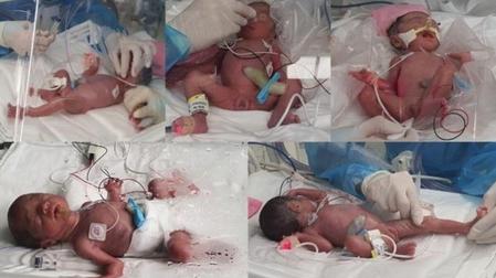 Las fotos compiladas, proporcionadas por el Hospital de la Universidad Nacional de Seúl