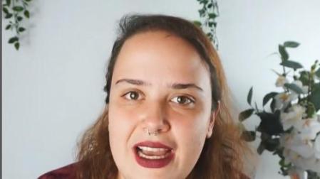 La instagramer Carlota Quiroga sufre alopecia androgenética desde los 14 años