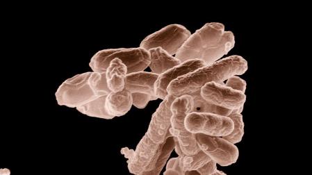 Micrografía electrónica de baja temperatura de un cúmulo de bacterias