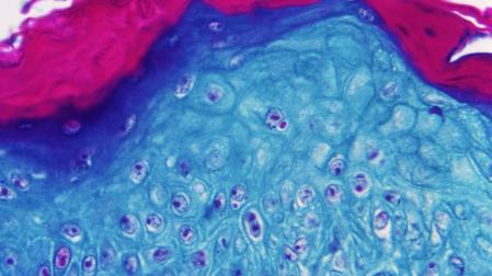 Imagen ampliada con un microscopio de una muestra de piel de un mono infectado con el virus de la viruela del mono