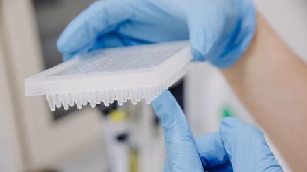 Una enfermera prepara una PCR para el análisis de la viruela del mono, en el Hospital Ramón y Cajal de Madrid