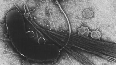 Bacteria del cólera