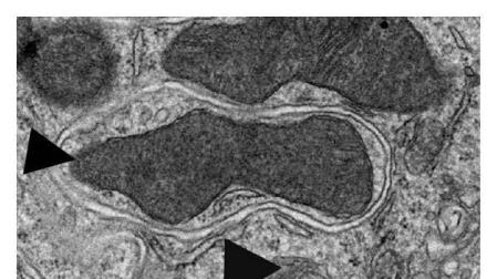 Imagen de microscopía electrónica de transmisión de una vesícula autofágica en el riñón de un ratón