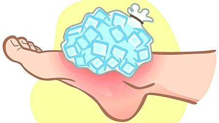 Ilustración de un pie lesionado tratado con hielo