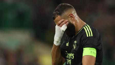 Karim Benzema se retira lesionado en el duelo de Champions contra el Celtic