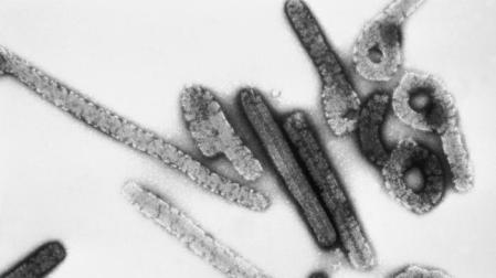 Virus de Marburgo