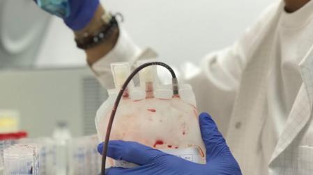 Investigadores desarrollan metodología para diagnóstico precoz de cáncer de mama con una sola muestra de sangre