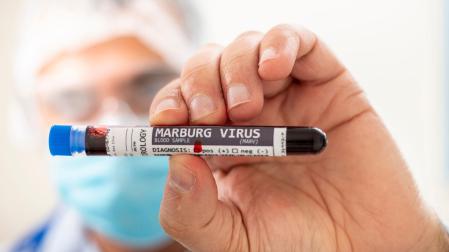 El virus de Marburgo es un virus de ARN altamente patógeno que pertenece al orden Mononegavirales y, al igual que el virus del ébol