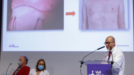 El jefe de Servicio de Cirugía Torácica y Trasplante Pulmonar de Vall d'Hebron, Albert Jauregui, durante la rueda de prensa en la que se ha anunciado que se ha llevado a cabo con éxito el primer trasplante pulmonar con cirugía completamente robótica