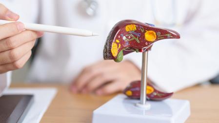El hígado graso es la enfermedad hepática más común en nuestros días y un problema de salud reconocido.