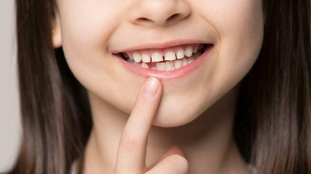 Los dientes temporales son conocidos como los famosos dientes de leche