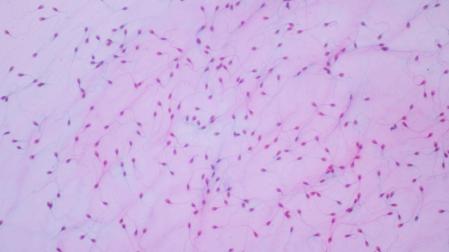 Vista de esperma humano al microscopio